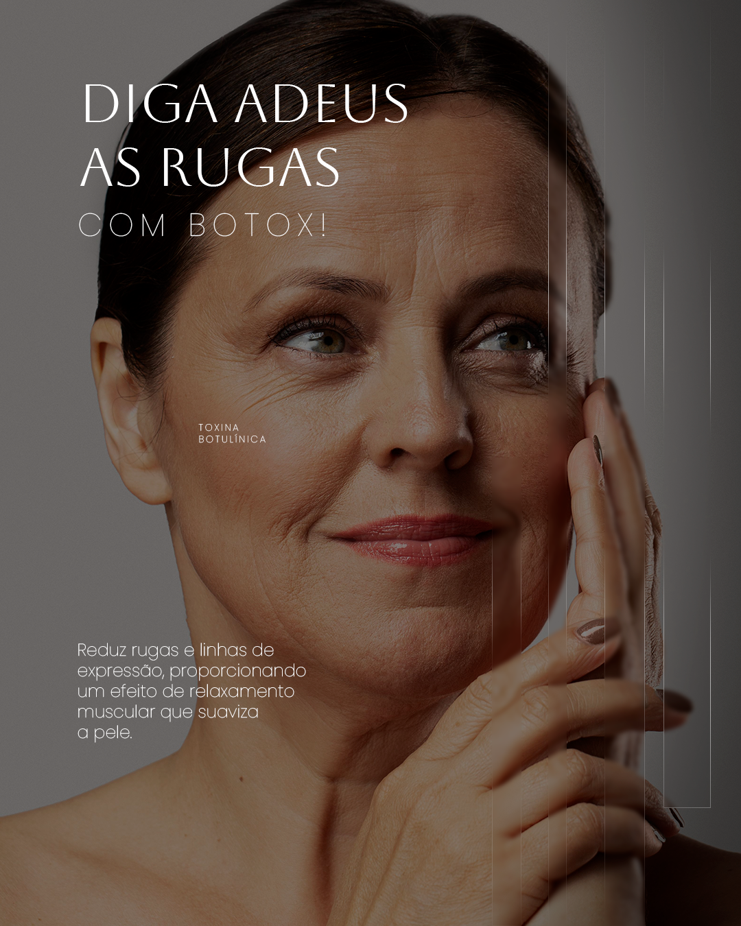 Diga adeus às rugas com Botox